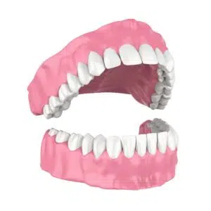 traditional denture, clear aligners treatment near me
