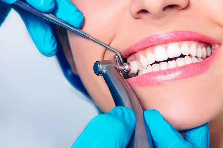 Professional Teeth Cleaning in Kelowna