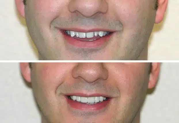 cosmetic dentistry in Kelowna