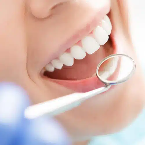 General dental services in kelowna